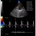 Cheap China Medical cor doppler Ultrasound Diagnostic System e ultra-som fabricante